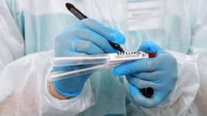 Dünyada koronavirusa yoluxanların sayı 1 milyon 345 mini keçdi